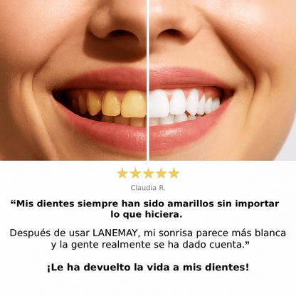 LANEMAY® V34 Pasta Blanqueadora - Lanemay Chile